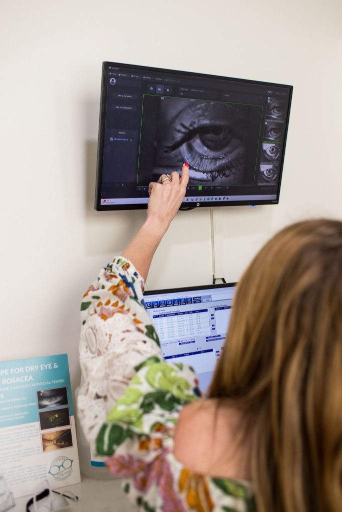 Dr. Denton pointing to a close-up image of a patient's eyelid on an exam room monitor